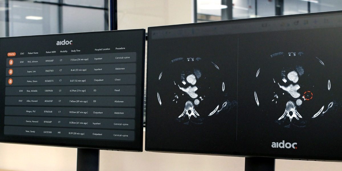 Aidoc使用人工智能来帮助放射科医生分析医疗扫描，该公司将其B系列扩大了2000万美元至4700万美元，使其筹资总额达到6000万美元